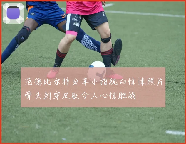 范德比尔特分享小指脱臼惊悚照片骨头刺穿皮肤令人心惊胆战